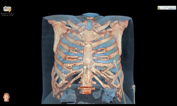 美国医学家用VR带你看被冠状病毒侵蚀后的肺部：损伤超乎想象